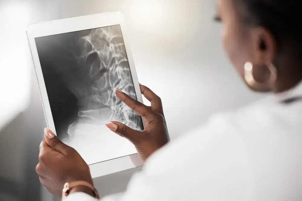 A doctor looking at an x-ray of bone density to look for osteoporosis