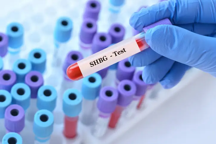 a doctor holding a lab test for SHBG