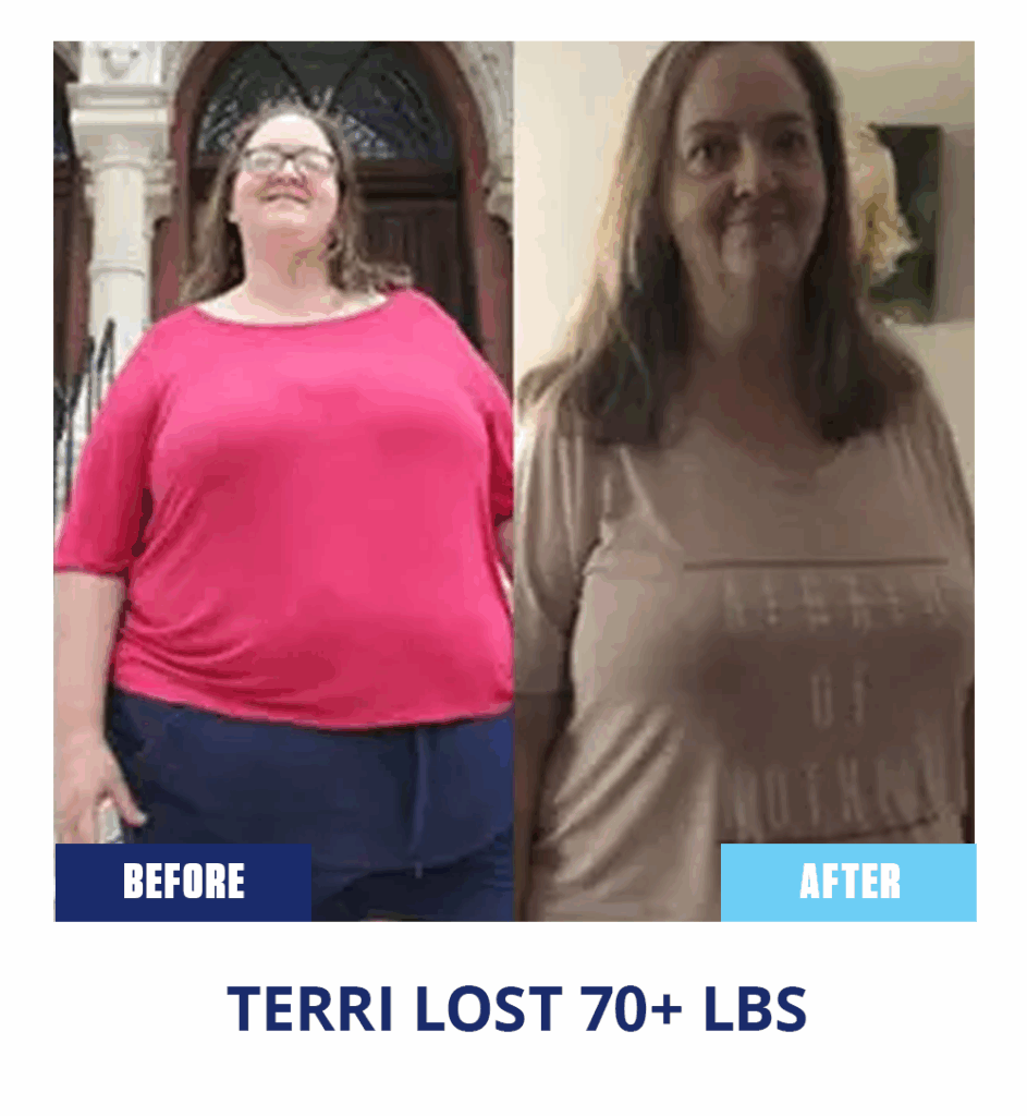 Terri lost 70 lbs with Blue Sky MD
