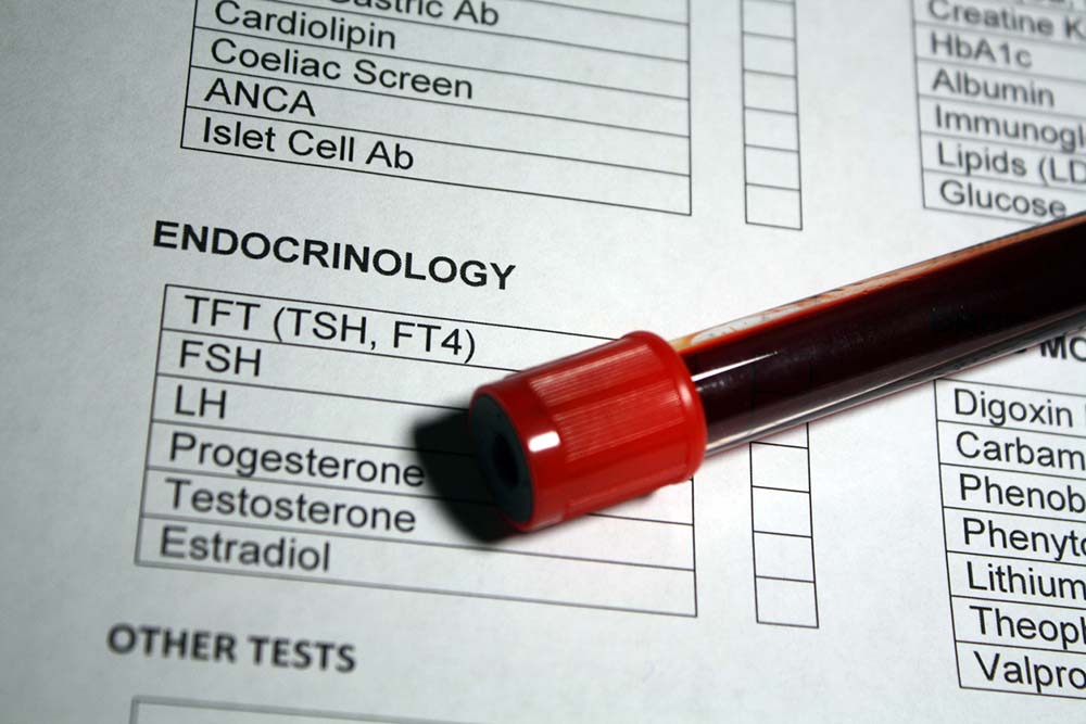 what does lh hormone do and why test for lh?